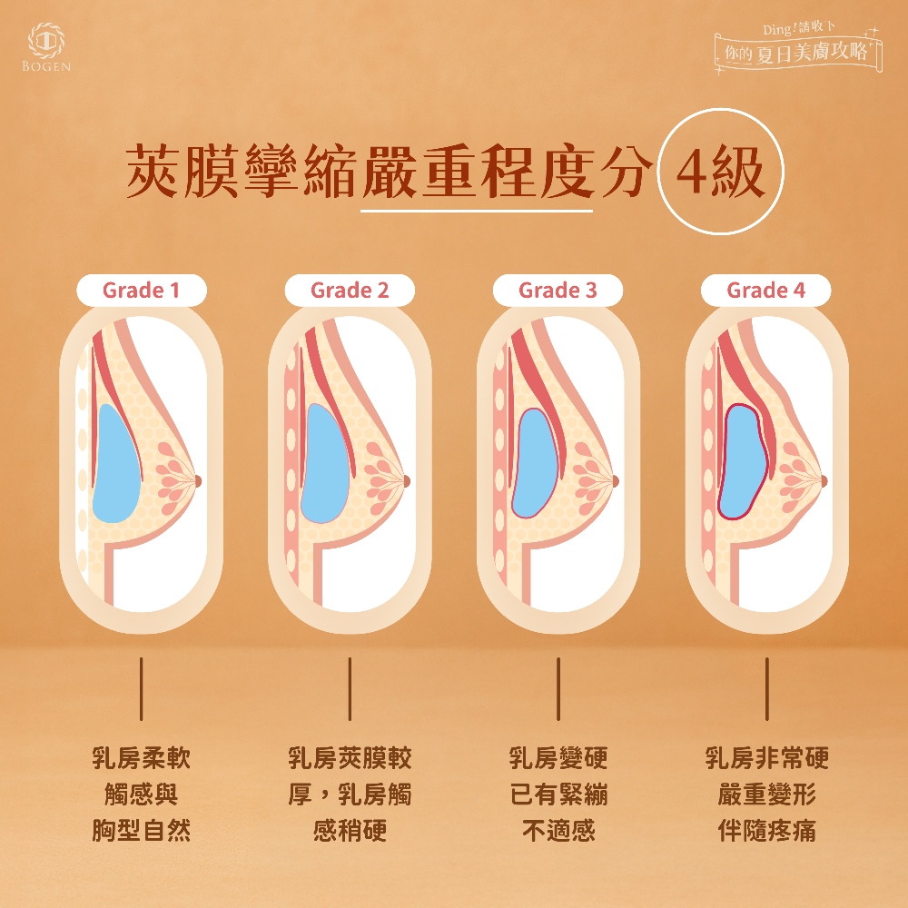 莢膜攣縮分級,莢膜攣縮,博恩妍